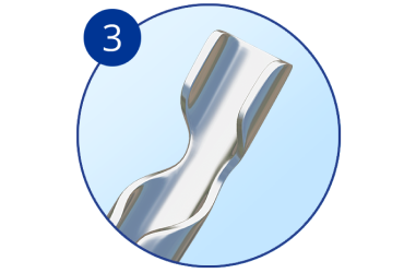 Drei runde Bilder mit Nahaufnahmen von Abschnitten des Hydrus Microstent Implantats. Die Kreise sind von eins bis drei nummeriert.
