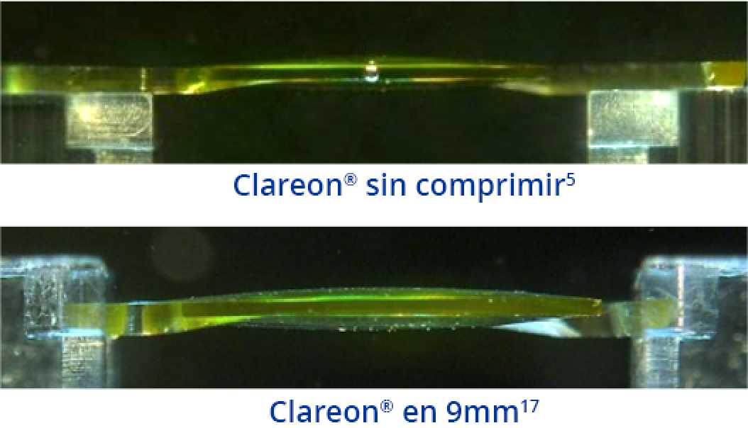 An image of the Clareon IOL from the side, depicting the shape of the IOL when uncompressed. An image of the Clareon IOL from the side, depicting the shape of the IOL with 9 mm compression.