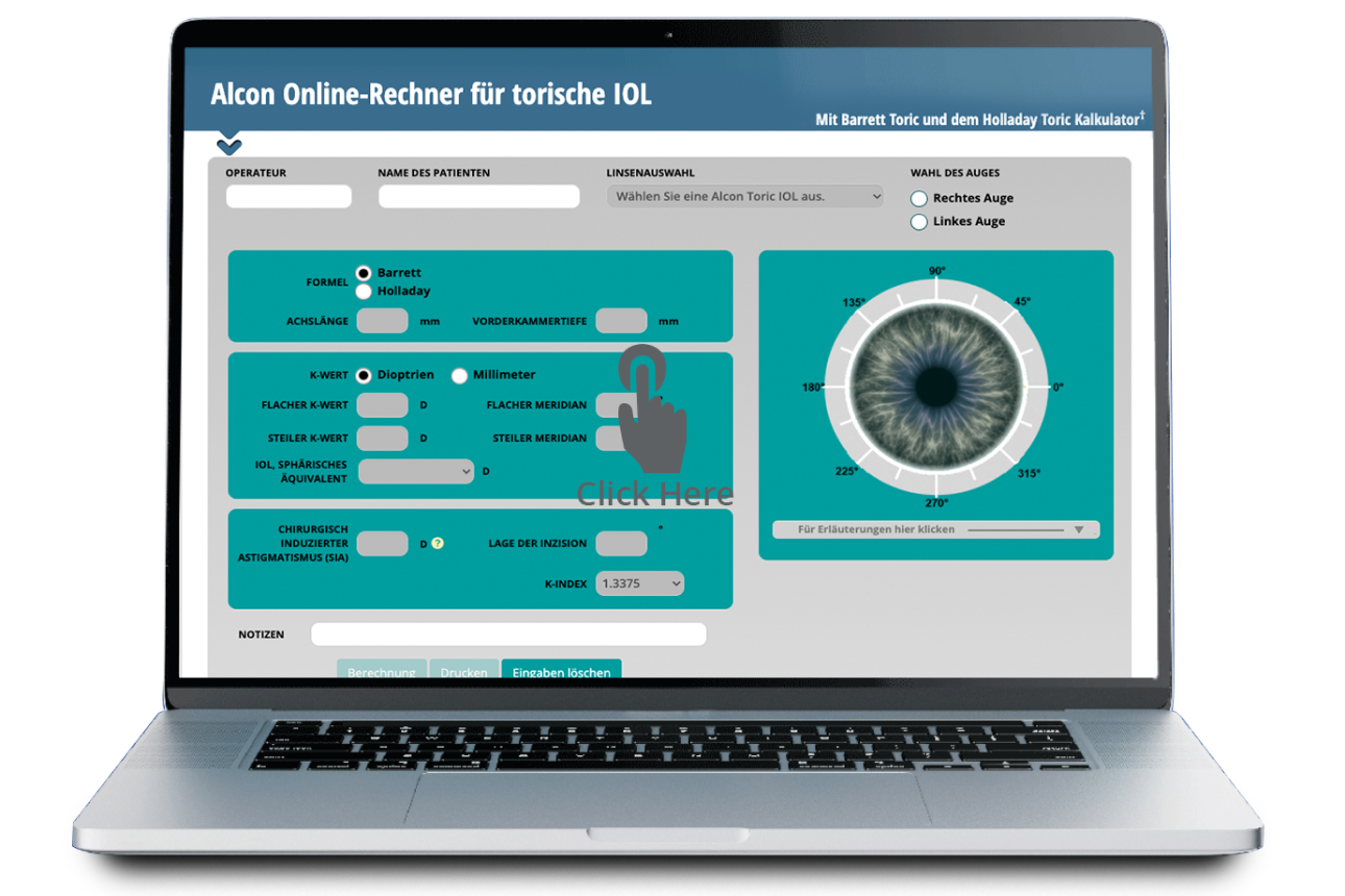 Geöffneter Laptop mit dem Alcon Online Toric IOL Calculator auf dem Bildschirm.