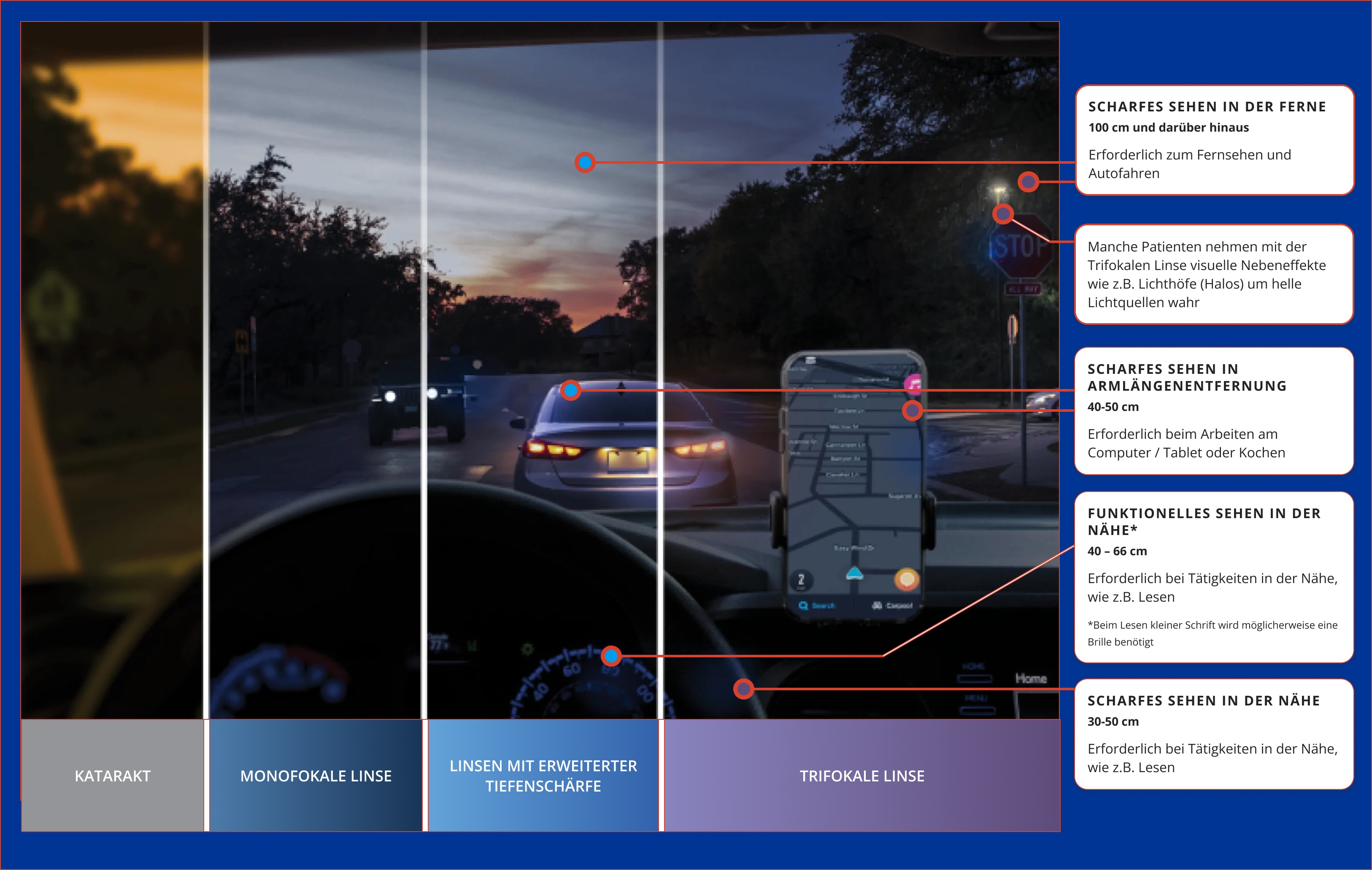 Blick eines Fahrers in einem Auto auf einer Straße bei schlechten Lichtverhältnissen. Auf dem Armaturenbrett ist ein Telefon angebracht, auf dem eine Navigationsapp zu sehen ist. Das Bild ist in 4 Bereiche aufgeteilt, um  den Unterschied in der individuellen Sehqualität zu zeigen zwischen: Patienten mit Grauem Star und solchen, die mit einer Monofokallinse, einer AcrySof® IQ Vivity® oder einer AcrySof® IQ PanOptix® versorgt wurden. Der Bereich ganz links ist verschwommen und gelblich verfärbt dargestellt, um die mit einem Grauen Star einhergehende, schlechtere Sicht zu zeigen. Die drei anderen Bereiche sind deutlich klarer, um den Vorteil einer IOL-Option zur Behandlung des Grauen Stars zu verdeutlichen.