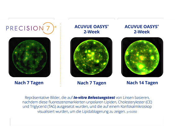 ergleichende Fluoreszenzbilder von Kontaktlinsen (PRECISION7 und ACUVUE OASYS 2-Week) nach 7 bzw. 14 Tagen, die Lipidablagerungen durch unterschiedlich starke grün leuchtende Bereiche zeigen.