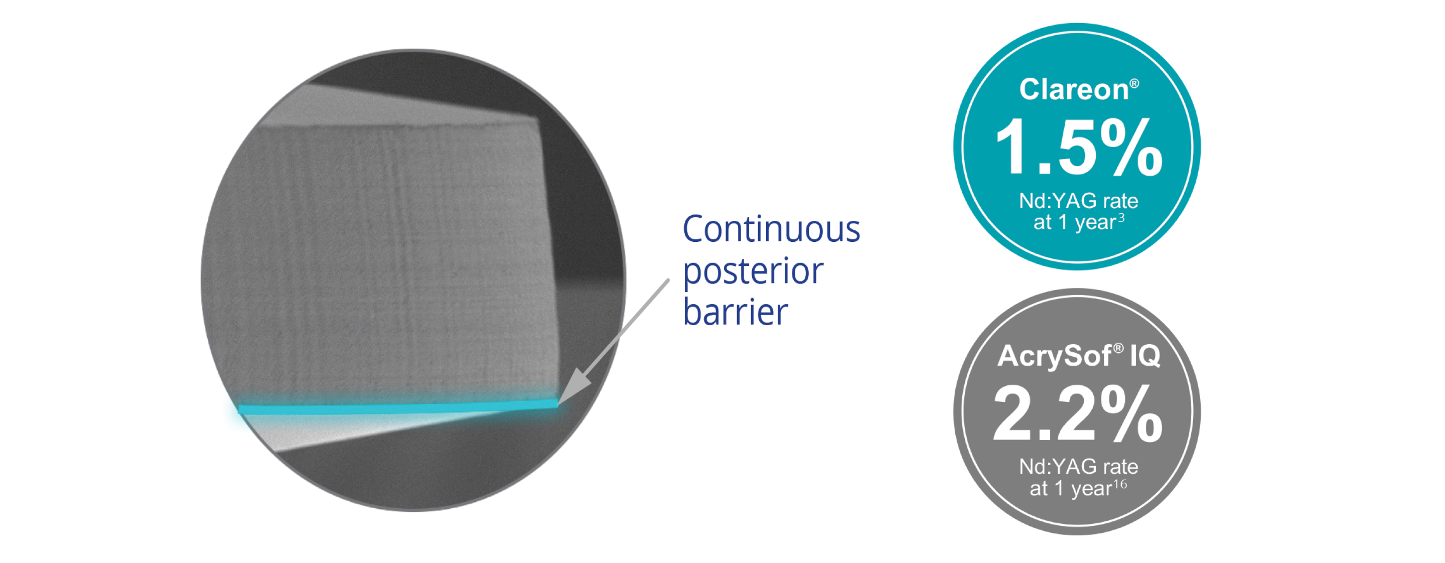 A circular visual of a microscopic image of the Clareon IOL with a teal-coloured line highlighting the continuous posterior barrier. Two circular callouts also appear. The first callout over a teal-coloured background states that the Clareon IOL achieves an Nd:YAG rate of 1.5% at 1 year. The second callout, over a grey background, states that the AcrySof IQ IOL achieves an Nd:YAG rate of 2.2% at 1 year.