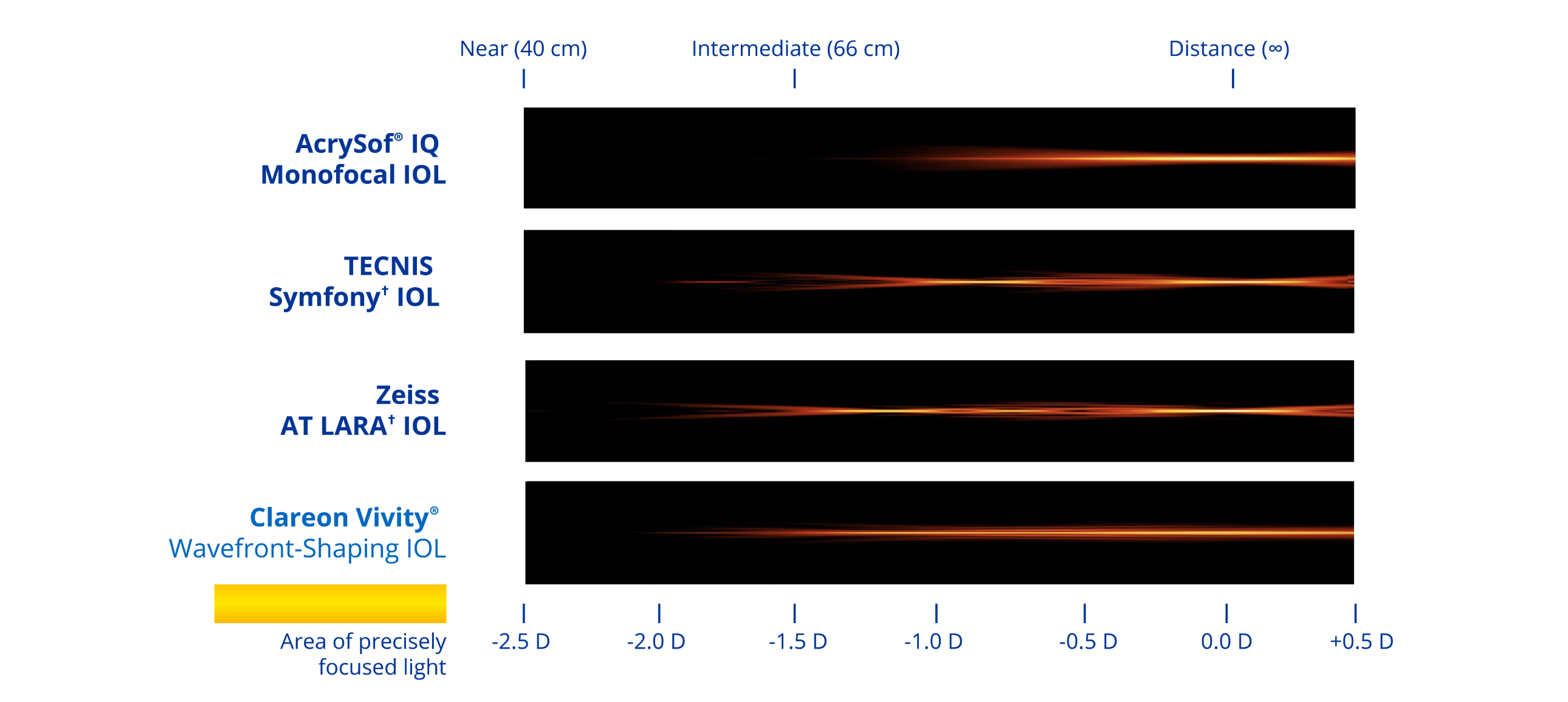 A graphic illustrating the simulated range of vision based on light intensity distribution with four different IOLs. The Clareon monofocal IOL provides distance vision. The TECNIS Symfony IOL provides distance, intermediate and near vision. The Zeiss AT LARA IOL provides vision at distance and two intermediate focal points. The Clareon Vivity IOL provides a continuous range of vision from distance to functional near.