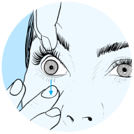 Graphic of preparation steps for contact lens removal