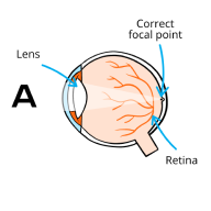 Infographic of eye