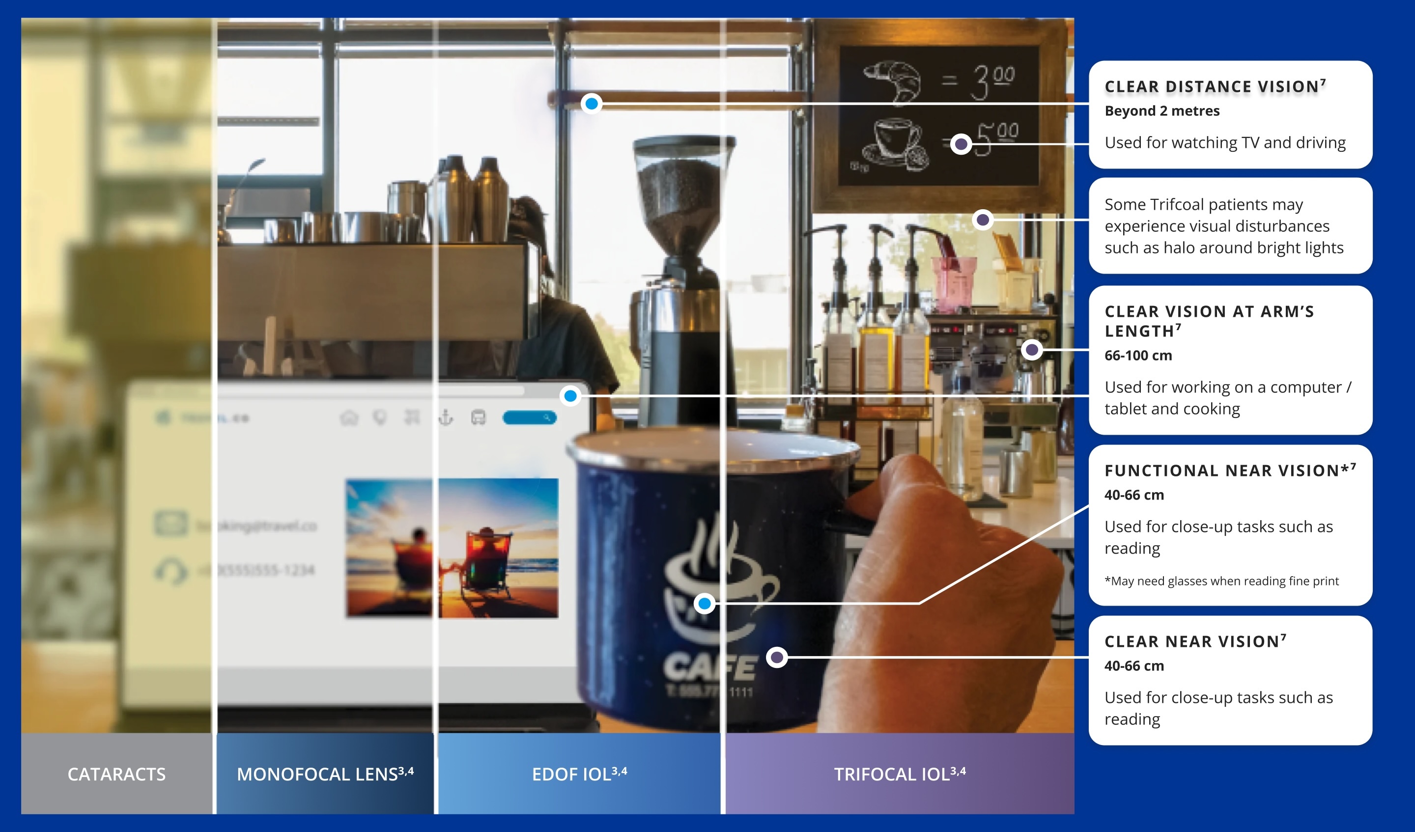 IOL Vision Simulator