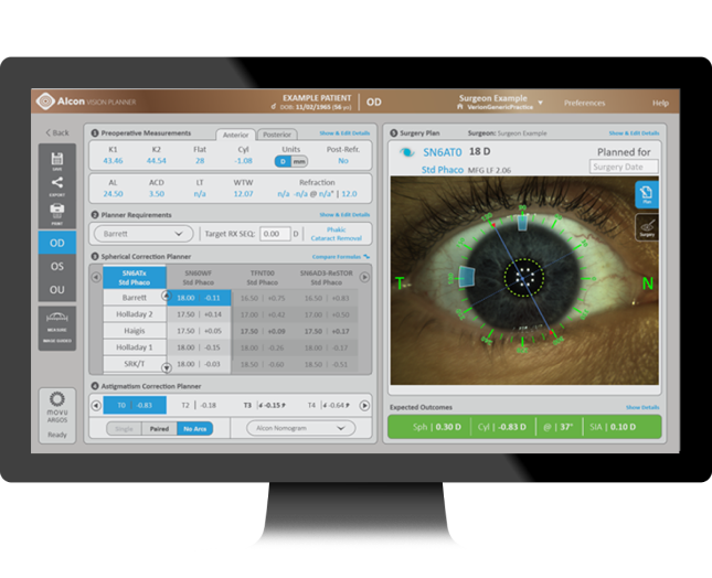 Imagem de uma tela de computador com a interface do usuário do Vision Planer da Alcon com dados de medição à esquerda e uma imagem do olho do paciente à direita.