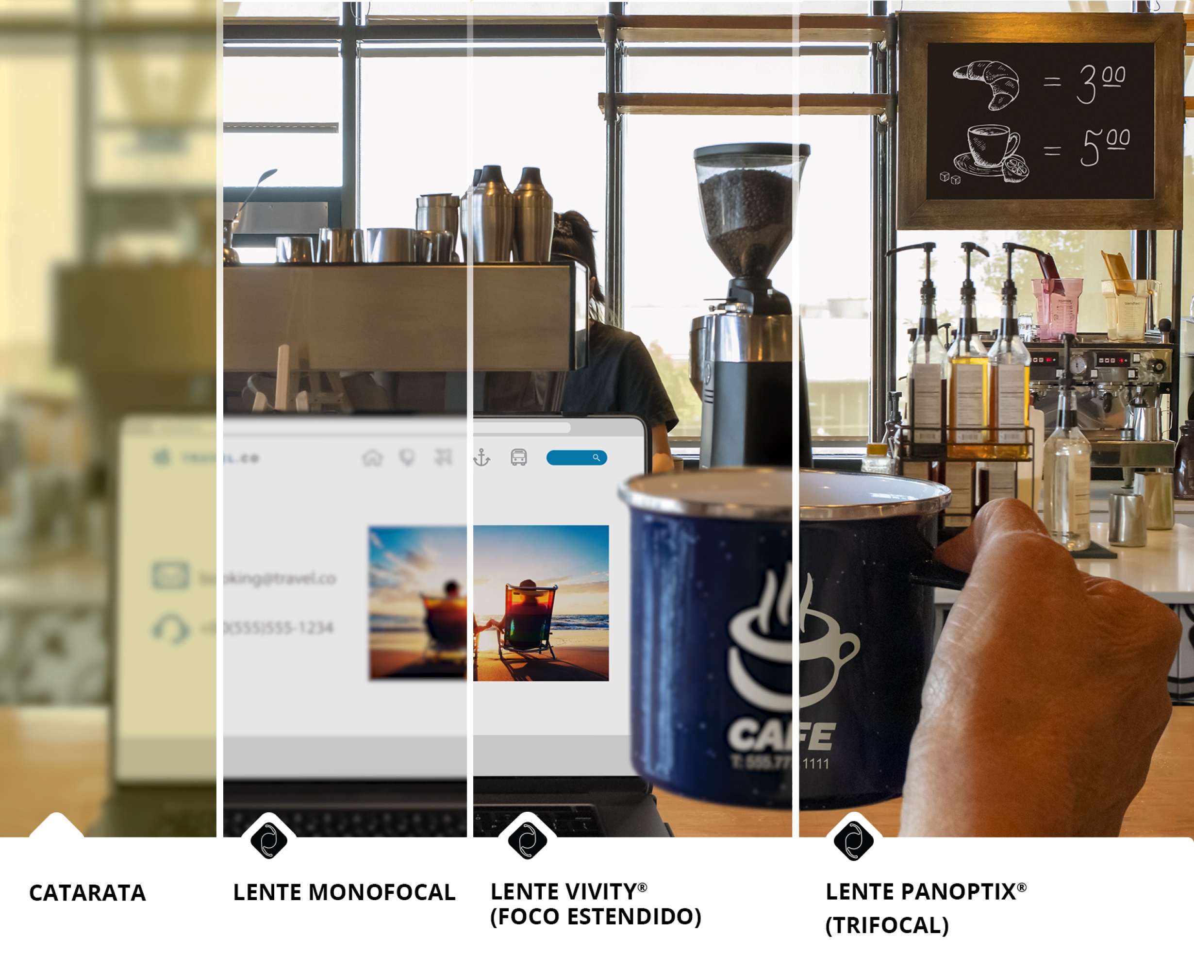 Cafeteria com vista para o balcão das máquinas de café e outros produtos. Um notebook está aberto na bancada e a mão de uma pessoa segura uma caneca de café à direita da tela do equipamento. A imagem está dividida em 4 seções para mostrar a diferença entre a qualidade de visão de um indivíduo com catarata comparativamente à visão com uma lente monofocal, lente de visão estendida, ou lente trifocal. A última secção à esquerda da imagem está desfocada e tem uma tonalidade amarela para ilustrar uma visão mais desfocada associada à catarata. As 3 secções restantes têm uma tonalidade significativamente mais clara para mostrar os benefícios visuais da utilização de uma LIO no tratamento da catarata.