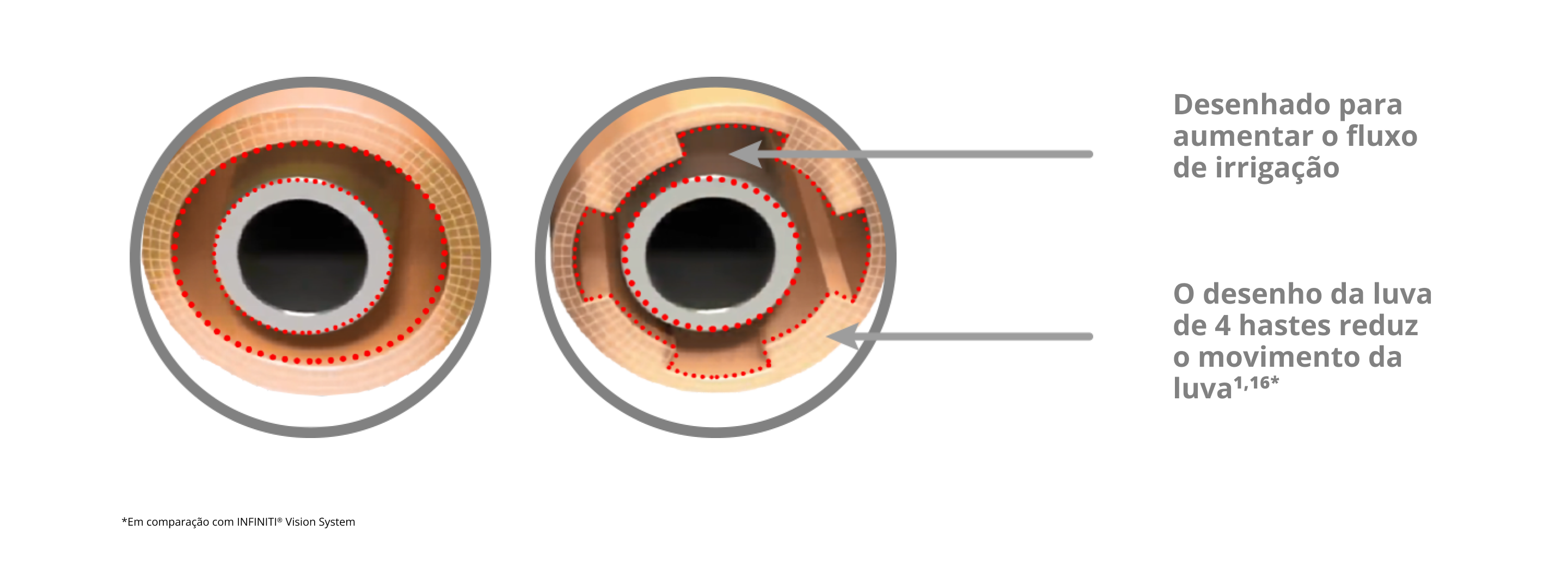 Imagem que mostra a luva de irrigação INTREPID com o design de 4 hastes, o qual reduz a movimentação da luva e aumenta o fluxo de irrigação em comparação com o INFINITI Vision System 
