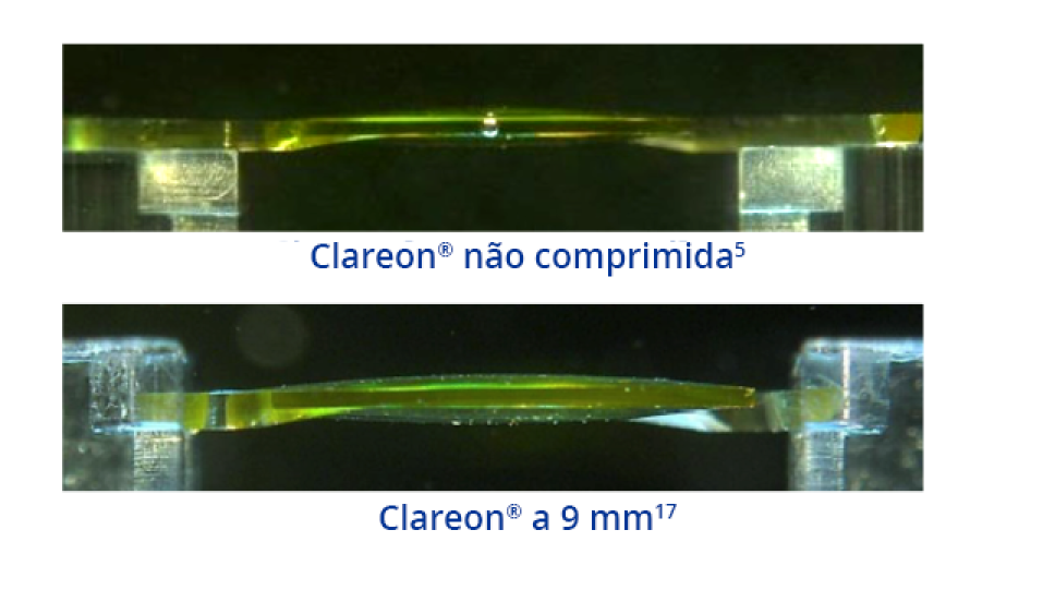 Uma imagem da LIO Clareon vista de lado, mostrando o formato da LIO quando não comprimida. Uma imagem da LIO Clareon vista de lado, mostrando o formato da LIO com compressão de 9 mm.