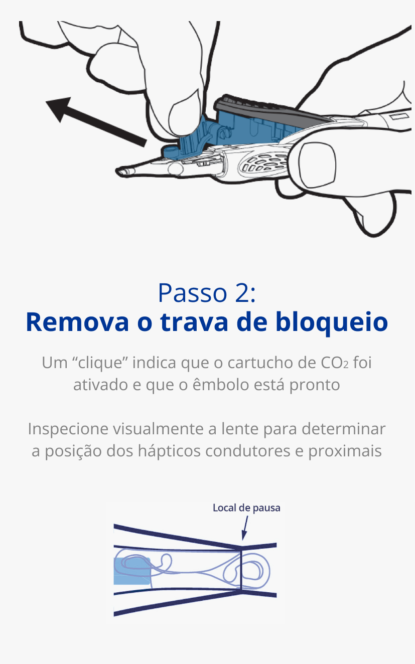 Ilustração de uma mão segurando o Injetor AutonoMe. Uma seta preta aponta para fora do cartucho para indicar o movimento de puxar. Ilustração do êmbolo/cartucho do Injetor AutonoMe. Uma seta azul escura aponta para a LIO dobrada no cartucho AutonoMe e pode ler-se 'Local de pausa'. 
