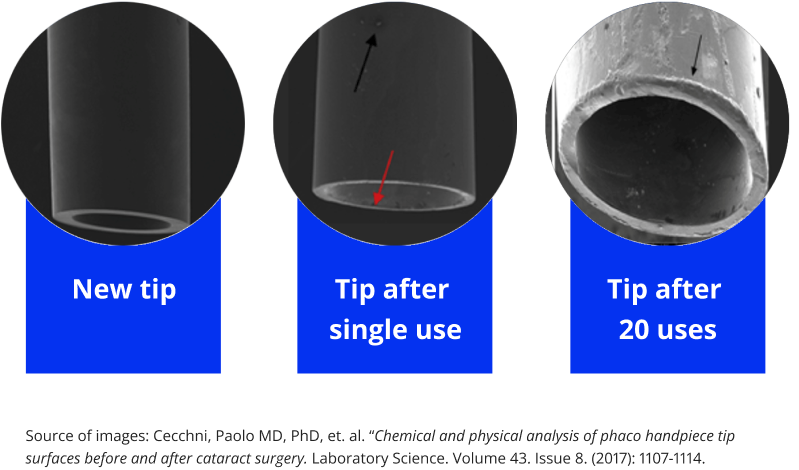 Three phaco tips are visible, a new one, a tip after single use and a tip after 20  uses.