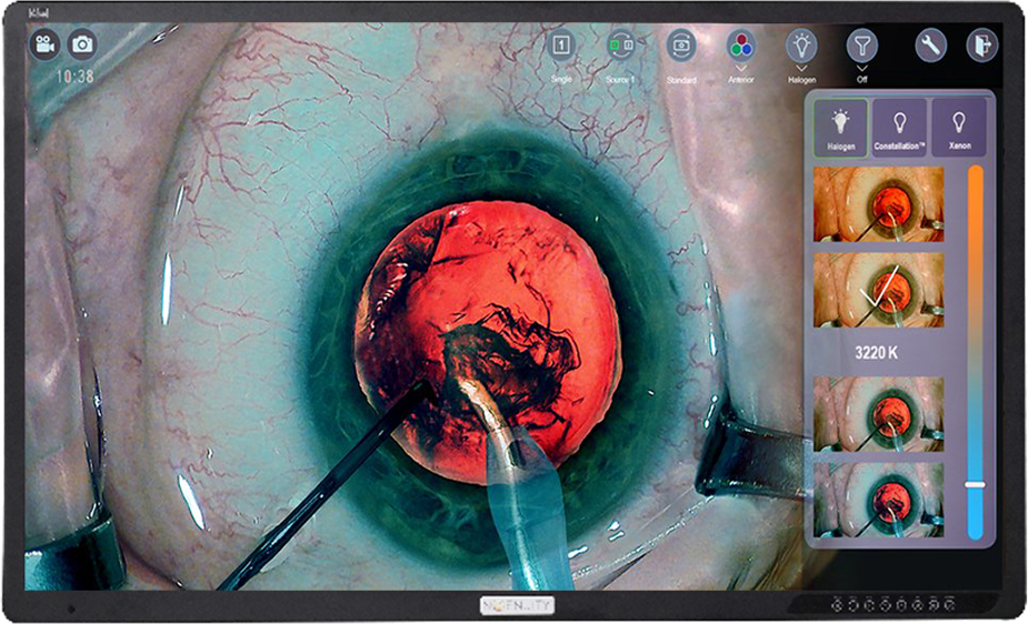 Close-up of the eye surgery