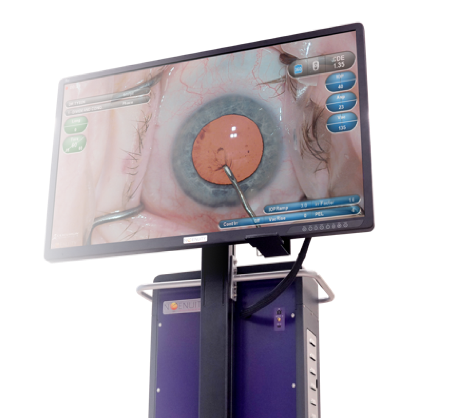 NGENUITY Image