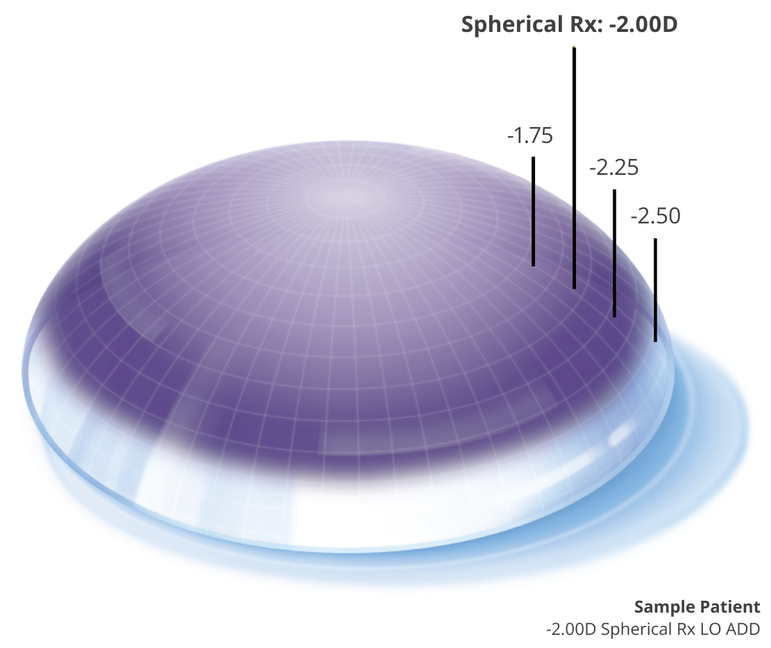 Precision profile image