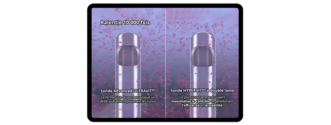 A computer-generated image showing the Advanced ULTRAVIT Probe tip on the left with text that reads, “Port closure causes pulsatile flow repelling tissue”, and the HYPERVIT Dual Blade Probe on the right with text that reads, “Continuously open port maximises control through improved efficiency and stability”. The probes are surrounded by vitreous humour to illustrate vitreous flow.