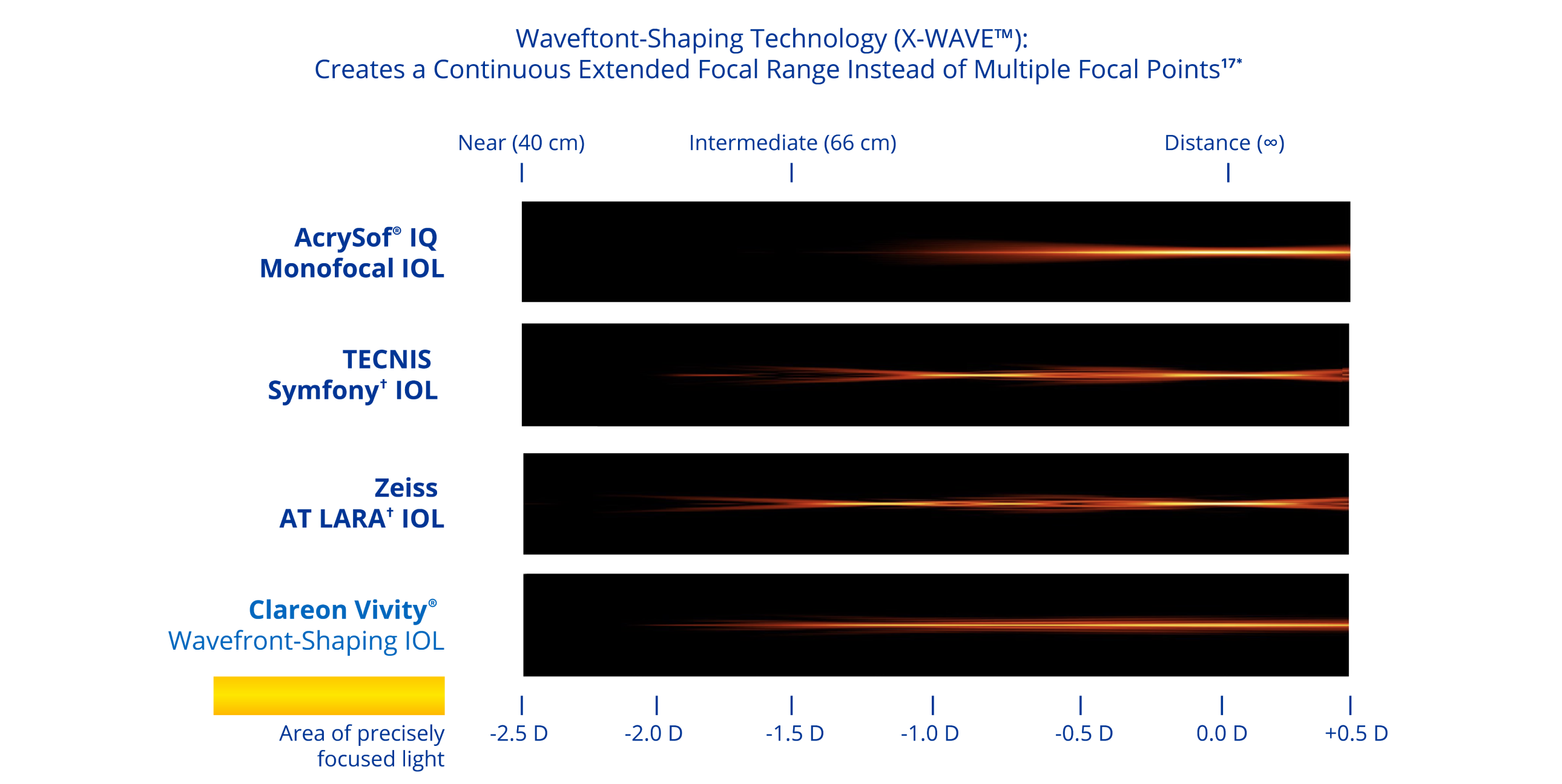A graphic illustrating the simulated range of vision based on light intensity distribution with four different IOLs. The Clareon monofocal IOL provides distance vision. The TECNIS Symfony IOL provides distance, intermediate and near vision. The Zeiss AT LARA IOL provides vision at distance and two intermediate focal points. The Clareon Vivity IOL provides a continuous range of vision from distance to functional near.
