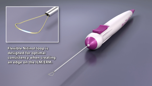 Der FINESSE Flex Loop vor grauem Hintergrund. Der Text daneben lautet: “flexible nitinol loop is designed for optimal consistency when creating an edge on the ILM/ERM.” Eine weiße Play-Taste zeigt an, dass dies ein Video ist.
