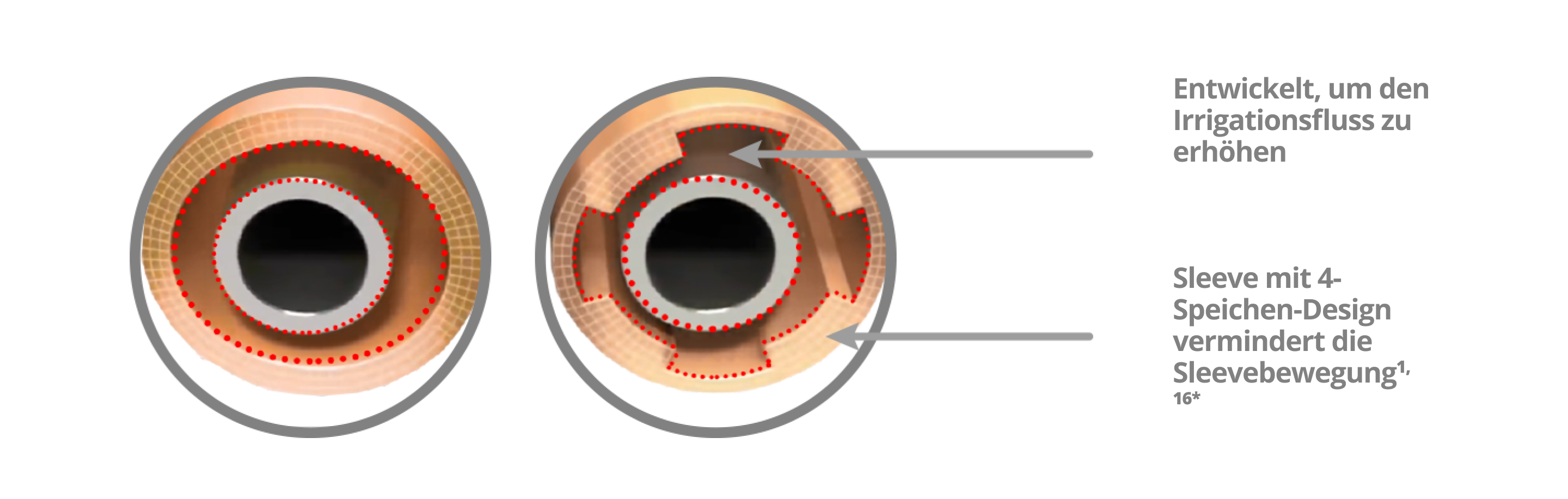 Ein Bild, das zeigt, wie der INTREPID Irrigationssleeve mit dem 4-Speichen-Design die Sleevebewegungen reduziert und den Irrigationsfluss im Vergleich zum Infiniti® Vision System erhöht.