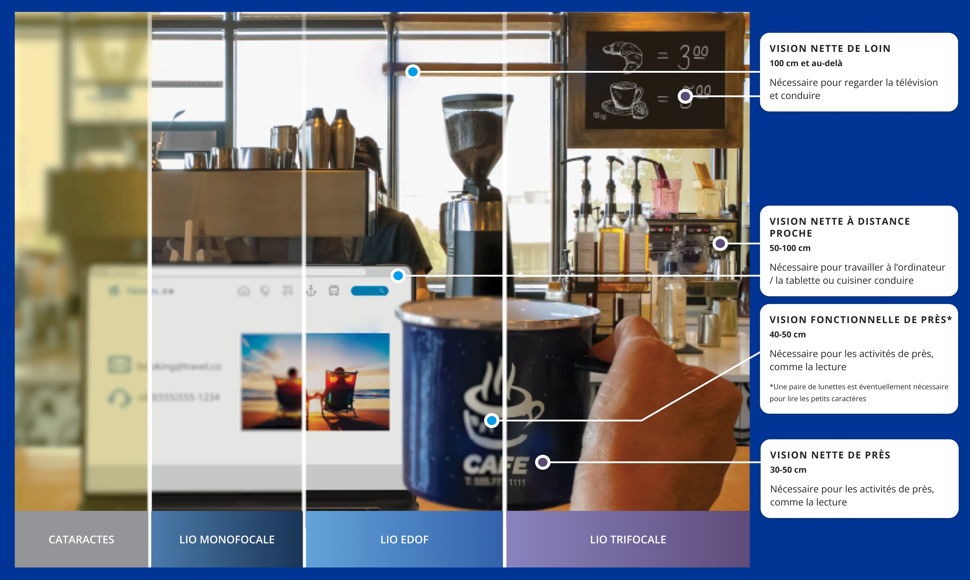 Coffee shop with a view of the area with coffee pots and other ingredients. There is a laptop open on the bar and a person's hand holding a cup of coffee to the right of the laptop screen. The image is divided into 4 sections to show the difference between the quality of vision of a person with cataracts compared to vision with single vision lenses, extended vision lenses or trifocal lenses. The left section of the image is blurred and yellowish to illustrate vision.  Translated with DeepL.com (free version)