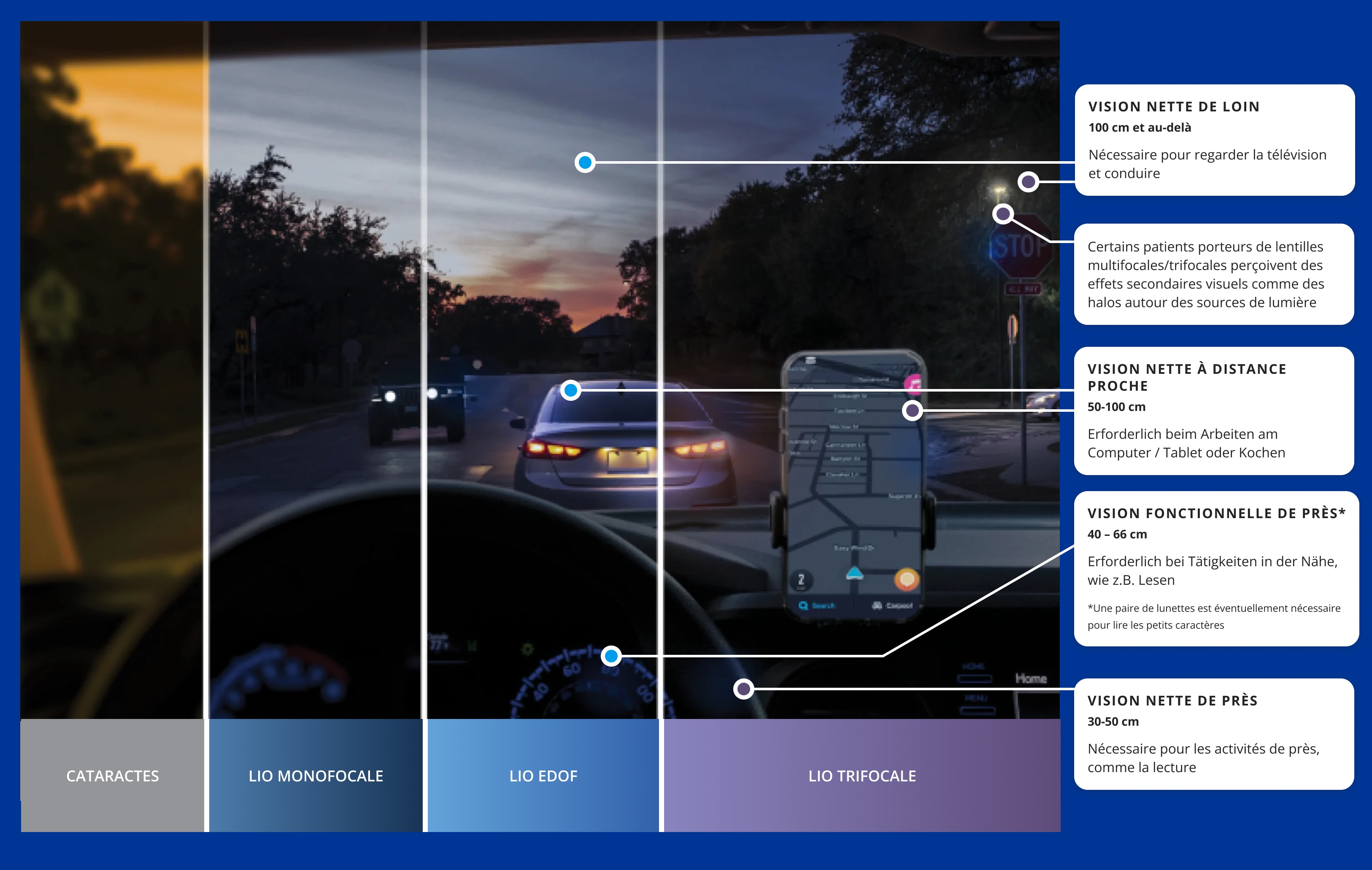 Driver's view inside a car on a road in low light conditions. There is a phone displaying a gps app mounted on the dashboard. The image is divided into 4 sections to show the difference between the quality of vision of a person with cataracts compared to vision with monofocal lenses, extended vision lenses or trifocal lenses. The left section of the image is blurred and yellowish to illustrate the duller vision associated with cataracts. The remaining 3 sections are significantly clearer to show the visual benefits of using an IOL option to treat cataracts.  Translated with DeepL.com (free version)