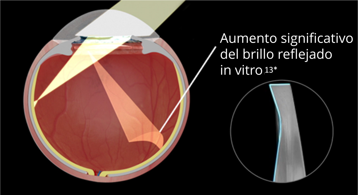 Imagen interna de un ojo con la LIO de borde recto implantada sobre fondo negro. Al entrar la luz en los ojos, la imagen muestra un aumento significativo del glare reflejado in vitro. Una imagen en otra burbuja resalta el diseño del borde de precisión de una LIO de borde recto.
