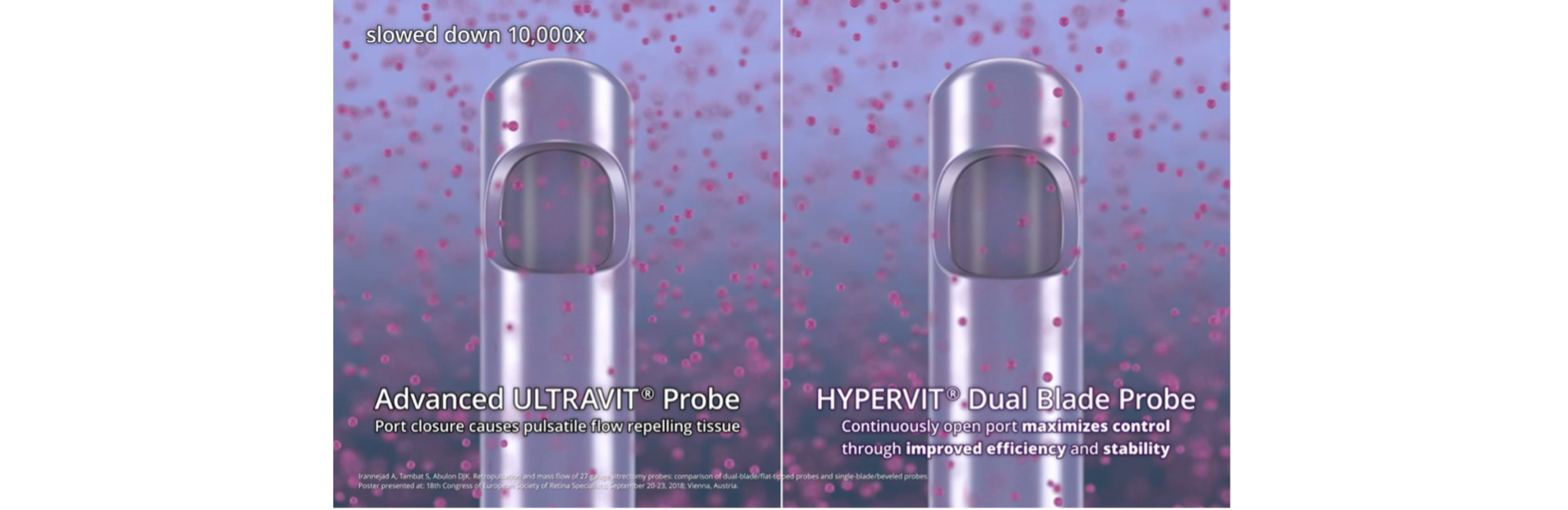 Imagen generada por ordenador que muestra la punta de la sonda Advanced ULTRAVIT a la izquierda con texto que dice: “El cierre del puerto causa flujo pulsátil repeliendo tejido”, y la sonda de hoja dual HYPERVIT, a la derecha, con texto que dice: “puerto continuamente abierto que maximiza el control a través de eficiencia y estabilidad mejoradas”. Las sondas están rodeadas de humor vítreo que ilustra el flujo vítreo. Un botón blanco de play indica que es un vídeo.