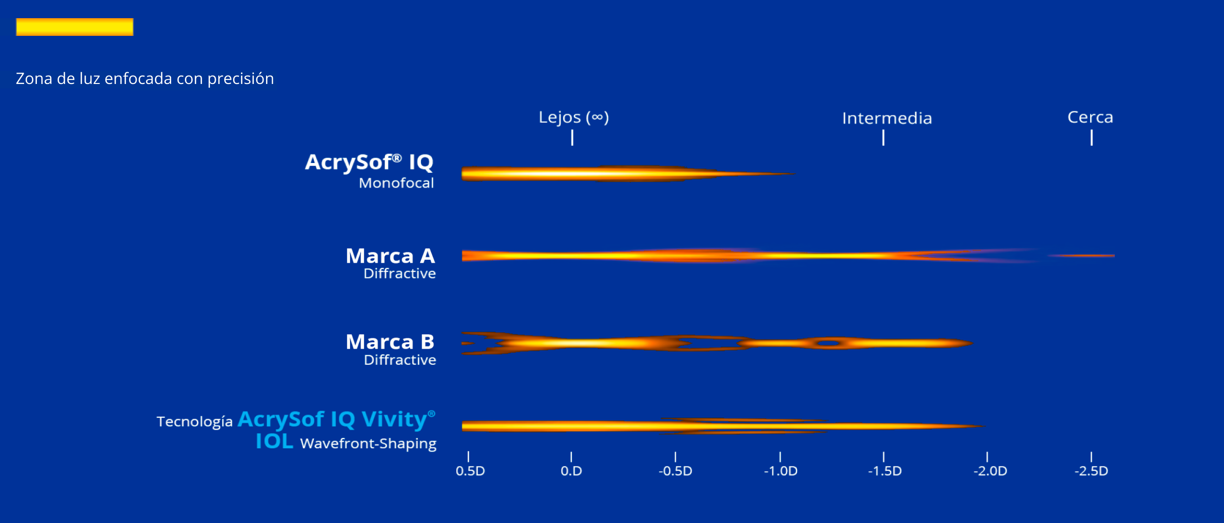 Gráfico que ilustra el rango de visión con cuatro LIOs diferentes. La LIO AcrySof® IQ monofocal proporciona visión de lejos. La LIO Symfony proporciona visión de lejos, intermedia y de cerca. La LIO AT LARA proporciona visión de lejos y dos puntos focales intermedios. La LIO AcrySof IQ Vivity® proporciona un rango continuo de visión desde lejos hasta la distancia de cerca funcional.