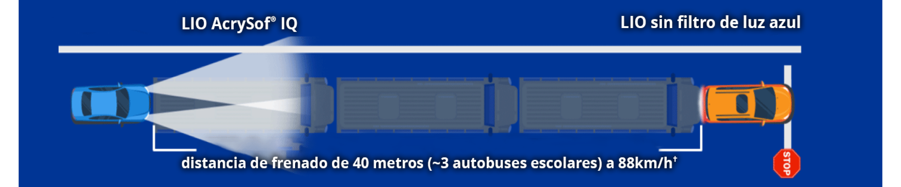 Ilustración que muestra un marco etiquetado como LIO AcrySof y un coche etiquetado como LIO sin filtro de luz azul. El texto dice: “distancia de frenado a 88 km/h de +40 metros (~3 autobuses).”