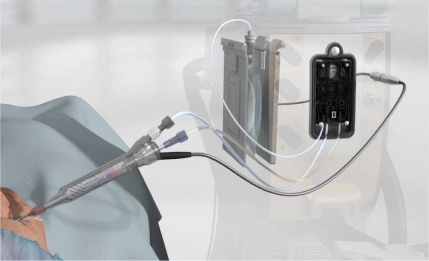 Ein animiertes Bild des Centurion® Vision Systems mit Plus-Schaltflächen, die den Irrigationsdrucksensor, das Active Sentry® Handstück, die Active Fluidics™ Technologie und die QuickValve™ Technologie hervorheben.