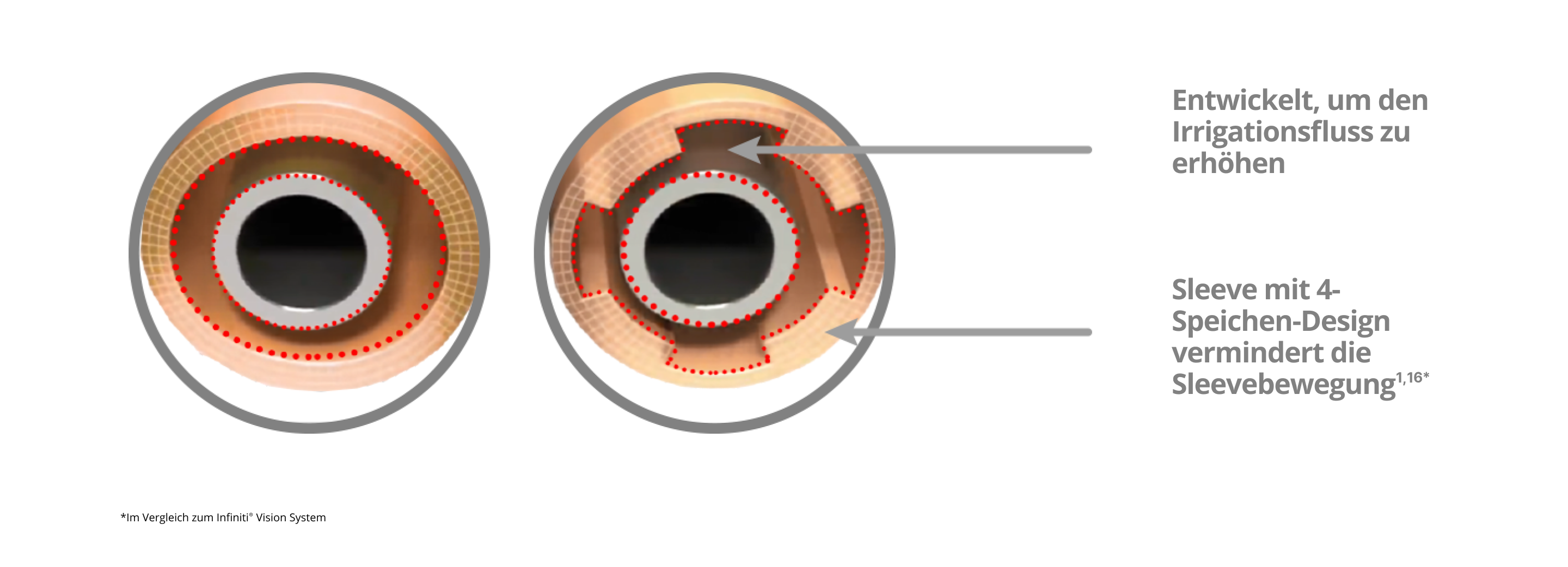 Ein Bild, das zeigt, wie der INTREPID Irrigationssleeve mit dem 4-Speichen-Design die Sleevebewegungen reduziert und den Irrigationsfluss im Vergleich zum Infiniti® Vision System erhöht.