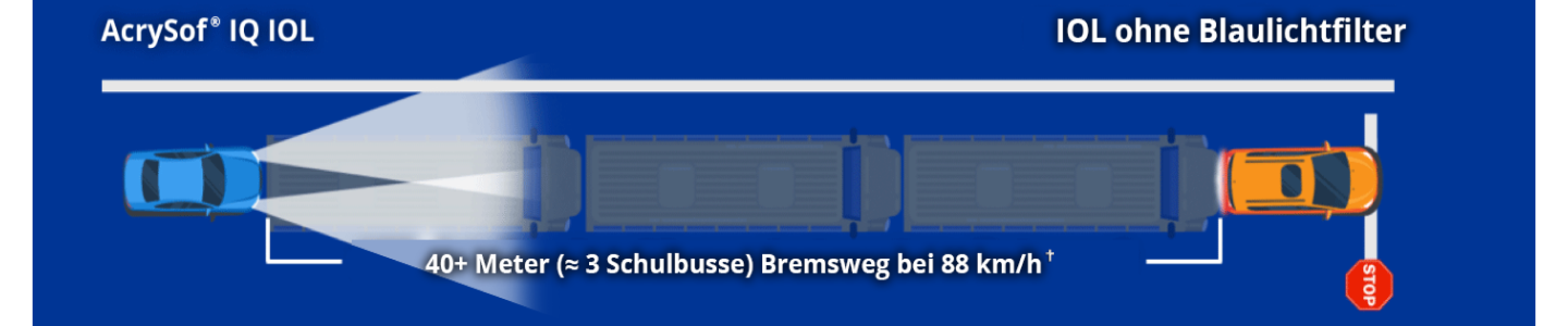 Die Illustration zeigt ein Auto mit der Aufschrift AcrySof IQ IOL und ein Auto mit der Aufschrift nicht-blaulichtfilternde IOL. Der Text auf dem Bildschirm lautet: "40+ Meter (~3 Schulbusse) Anhalteweg bei 88 km/h".
