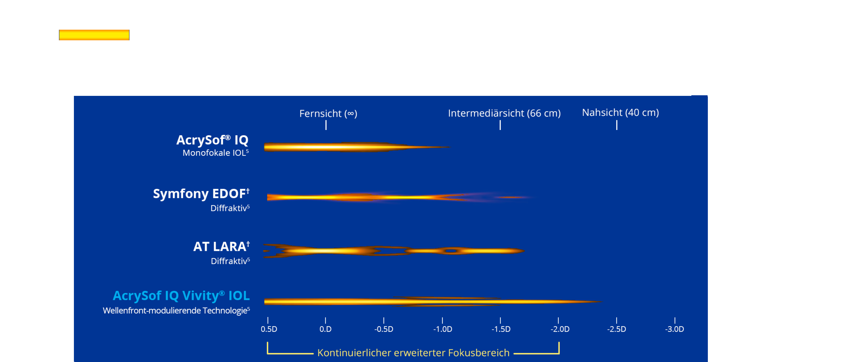 Die Grafik veranschaulicht die Sehbereiche, die mit vier verschiedenen IOL erreicht werden. Die AcrySof® IQ Monofokallinse bietet einen Fokuspunkt für die Ferne. Die Symfony IOL bietet Fokuspunkte für Ferne, Intermediär und Nähe. Die AT LARA IOL bietet einen Fokuspunkt für die Ferne und zwei für Intermedär. Die AcrySof IQ Vivity® IOL erzeugt keine einzelnen Fokuspunkte, sondern einen kontinuierlich erweiterten Fokusbereich für Sehen von der Ferne bis zu funktionaler Nähe.