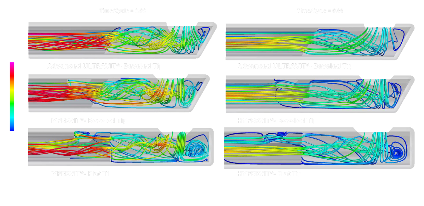 Ein Bild das den Rückfluss der Advanced ULTRAVIT, HYPERVIT Beveled Tip und der HYPERVIT mit geradem Tip Sonden in Kochsalzlösung und Vitreus vergleicht. Die  HYPERVIT Beveled Tip Sonde weist einen reduzierten Rückfluss im Vergleich zu anderen Sonden auf.