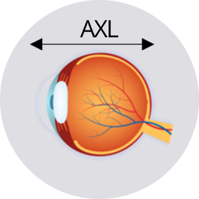 Schematische Darstellung des Auges mit Messung der axialen Augenlänge.