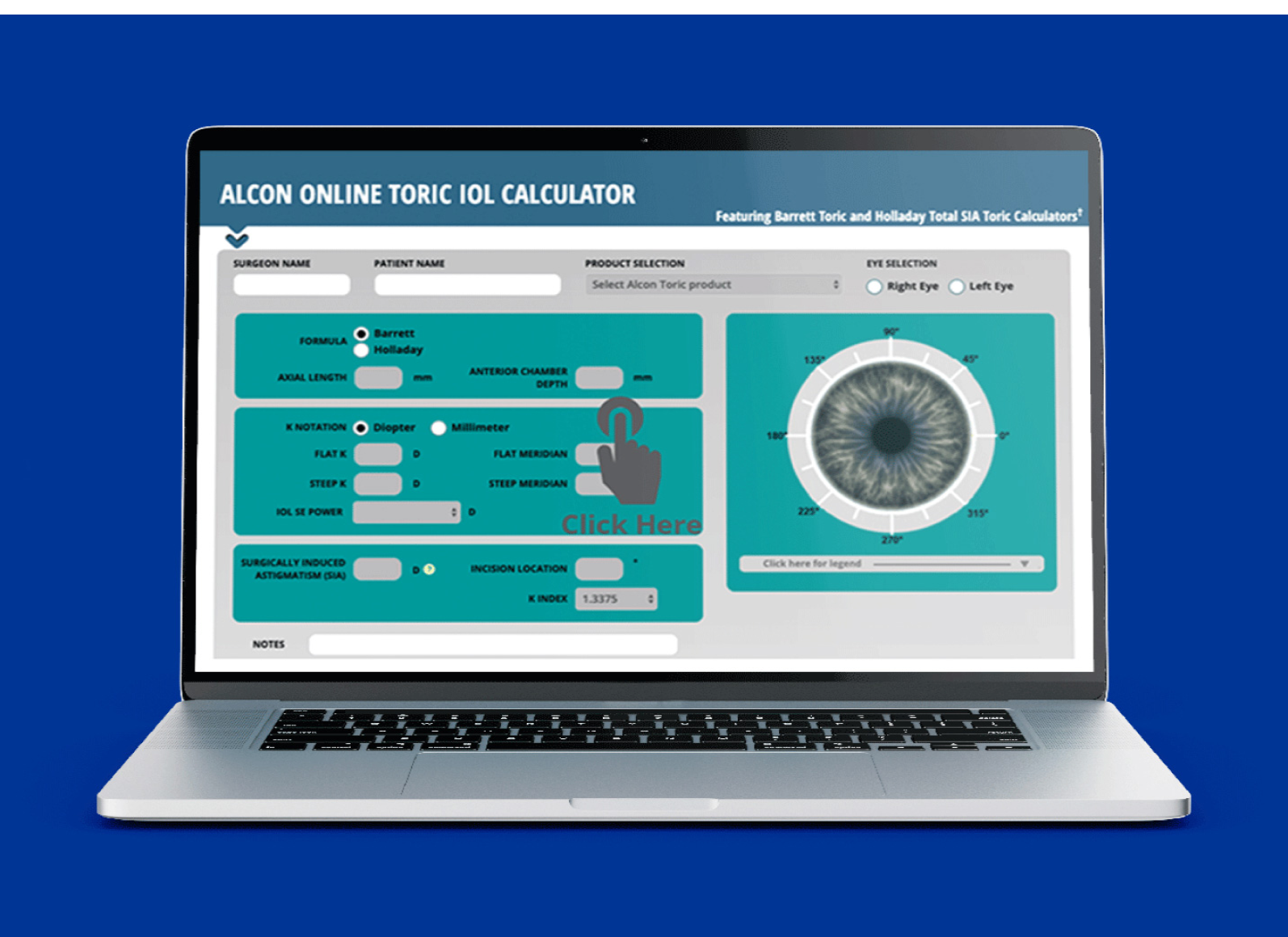 Ein Bild eines offenen Laptops mit dem Alcon Online Toric IOL Calculator auf dem Bildschirm.