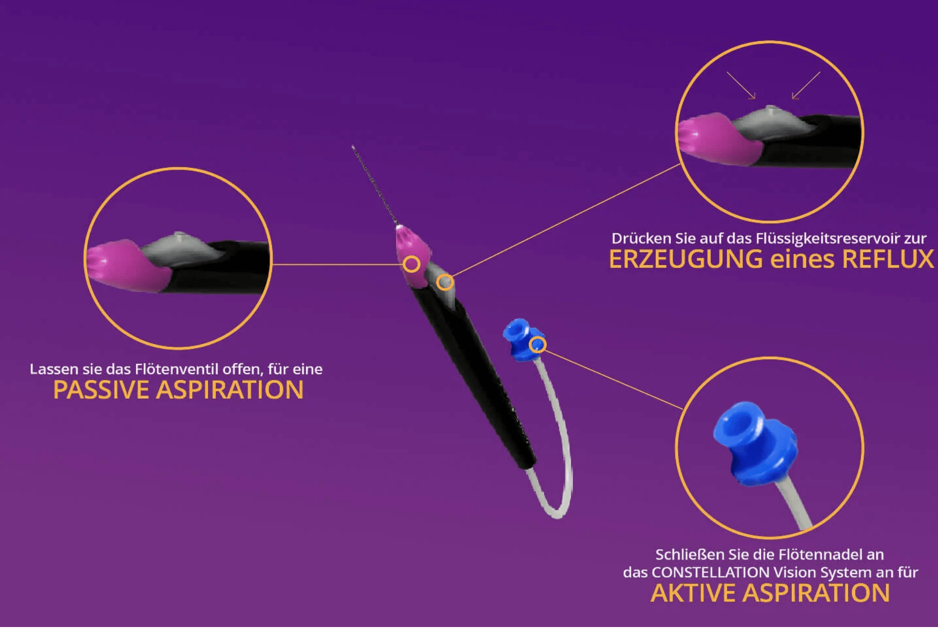 Grieshaber® Advanced Backflush Soft Tip DSP mit Flötenventil, Flüssigkeitsreservoir und Anschluss für aktive Aspiration.
