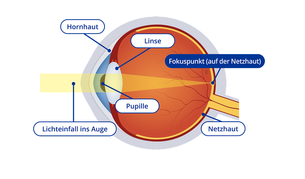 Ein Diagram vom Inneren eines rechtsichtigen Auges. Das Diagram zeigt einen gelben Lichtstrahl, der in das Auge eintritt und der Fokuspunkt auf der Netzhaut liegt. Bestimmte Bereiche des Auges sind hervorgehoben. Diese Bereiche sind die Hornhaut, die Linse, die Pupille und die Netzhaut.