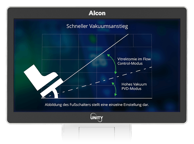 Monitor zeigt ein Diagramm mit dem Titel „Schnelles Vakuum-Ramping“ mit Fußsteuerungssymbol, das die Vitrektomie unter Flusskontrolle und Hochvakuum-PVD-Modus vergleicht.