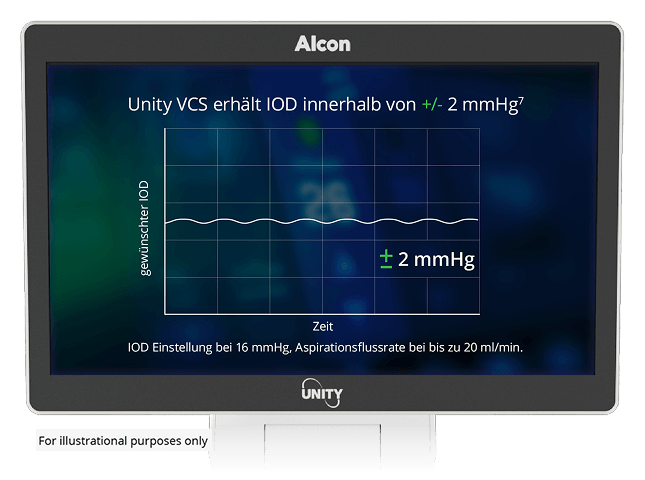 Monitor zeigt ein Diagramm mit dem Text „UNITY VCS hält den IOP innerhalb von ±2 mmHg“, das einen konstanten intraokularen Druck über die Zeit anzeigt.