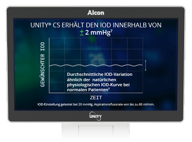 Monitor zeigt ein Diagramm mit dem Text „UNITY VCS hält den IOP innerhalb von ±2 mmHg“, das einen konstanten intraokularen Druck über die Zeit anzeigt.