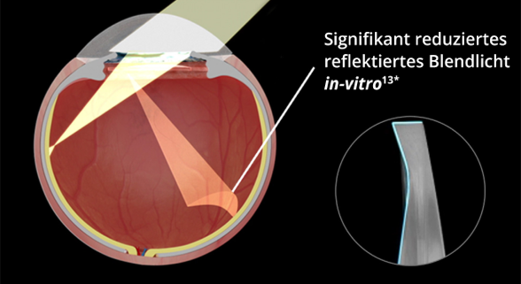 Ein internes Bild eines Auges, dem eine IOL mit rechteckigem Kantendesign implantiert wurde, vor einem schwarzen Hintergrund. Wenn Licht in das Auge eintritt, zeigt das Bild in vitro deutlich mehr reflektierte Blendung. Ein Bild in einem kleinen Kreis verdeutlicht das Präzisionskantendesign einer IOL mit rechteckigen Kanten.