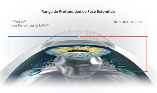 Sección transversal de un ojo que muestra la profundidad de foco extendida con Revalia comparado con otros microscopios.