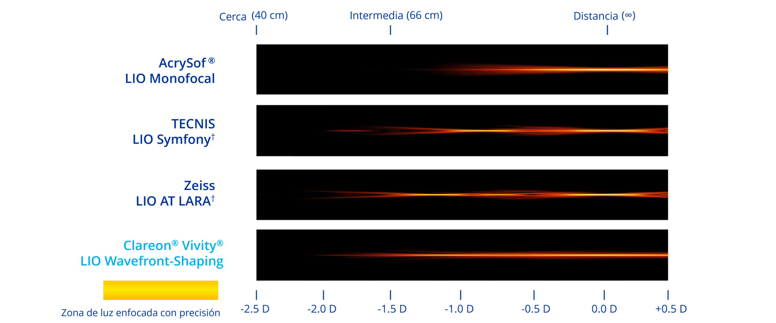 A graphic illustrating the simulated range of vision based on light intensity distribution with four different IOLs. The Clareon monofocal IOL provides distance vision. The TECNIS Symfony IOL provides distance, intermediate and near vision. The Zeiss AT LARA IOL provides vision at distance and two intermediate focal points. The Clareon Vivity IOL provides a continuous range of vision from distance to functional near.
