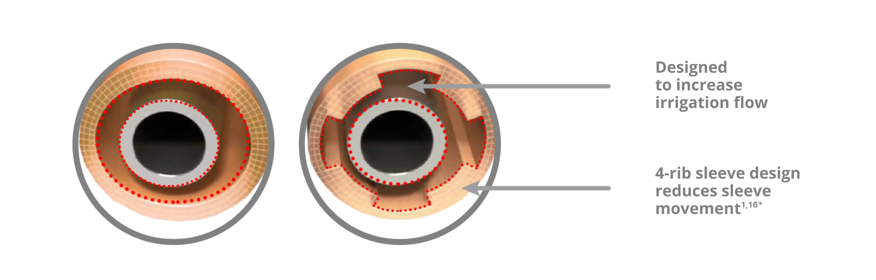 An image of that showcases the INTREPID irrigation sleeve with a 4-rib sleeve design which reduces sleeve movement and increases irrigation flow compared to the INFINITI Vision System