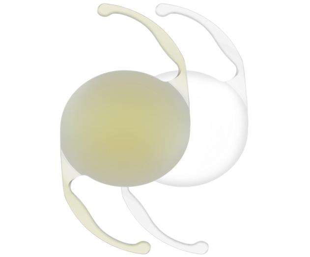 Imagen tridimensional de una LIO amarilla AcrySof IQ Monofocal y una LIO transparente AcrySof IQ Monofocal lado a lado.