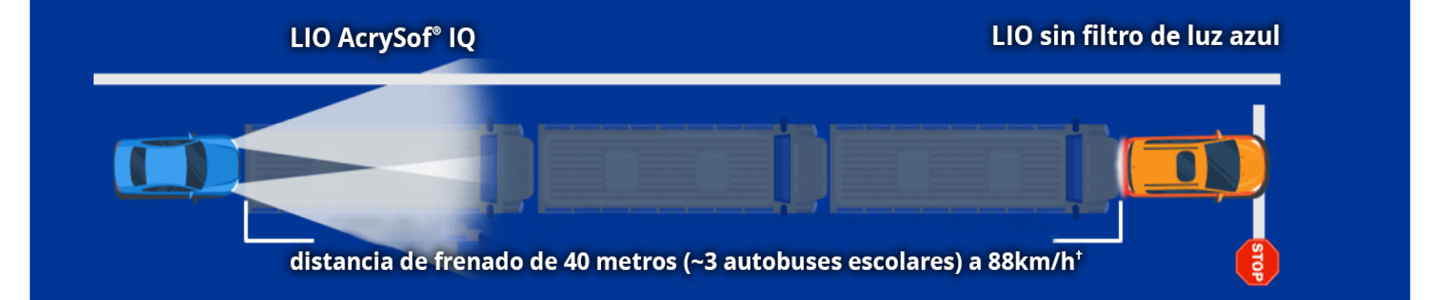 Ilustración que muestra un marco etiquetado como LIO AcrySof y un coche etiquetado como LIO sin filtro de luz azul. El texto dice: “distancia de frenado a 88 km/h de +40 metros (~3 autobuses).”