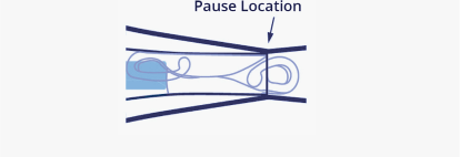 Ilustración de la pieza del émbolo/cartucho del sistema inyector AutonoMe. Una flecha azul oscuro apunta hacia la LIO doblada que está en el cartucho de AutonoMe con un texto que dice “Ubicación de pausa”.