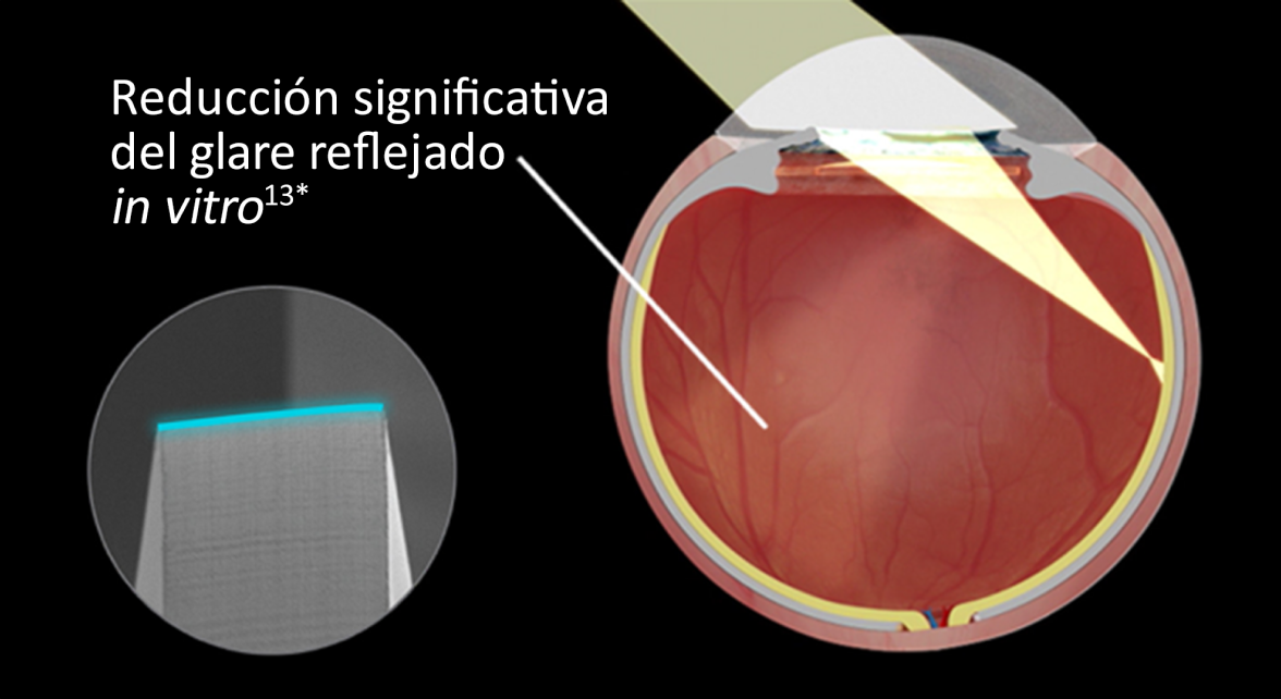 Imagen interna de un ojo con la LIO Clareon implantada sobre fondo negro. Al entrar la luz en los ojos, la imagen muestra la reducción significativa del glare reflejado in vitro. Una imagen en otra burbuja resalta el diseño del borde de la LIO Clareon.