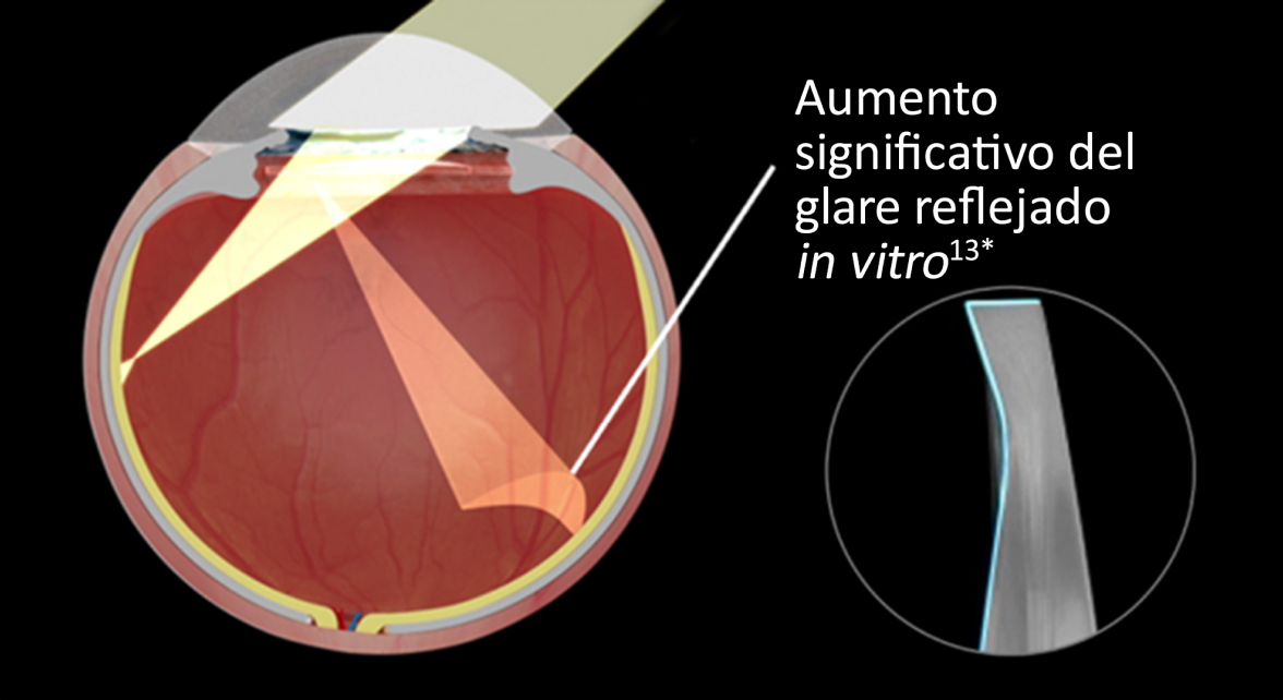 Imagen interna de un ojo con la LIO de borde recto implantada sobre fondo negro. Al entrar la luz en los ojos, la imagen muestra un aumento significativo del glare reflejado in vitro. Una imagen en otra burbuja resalta el diseño del borde de precisión de una LIO de borde recto.